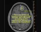A scan from Michael Prinke's MRI as uploaded by his wife on social media