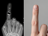 Bone Biologics files patent for novel bone regeneration technology (Image source: AI-generated illustrative image)