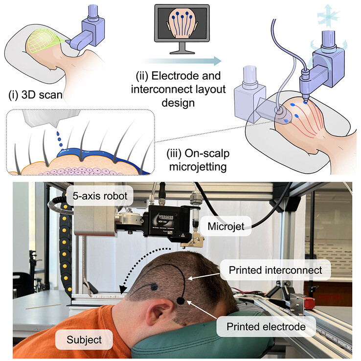 A microjet mounted on a robotic arm sprays biocompatible, conductive material onto the scalp to form electrical connections, replacing an EEG cap. (Image source: Vasconcelos et al. in Cell Biomaterials)